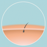 image animé expliquant le systeme anti douleur